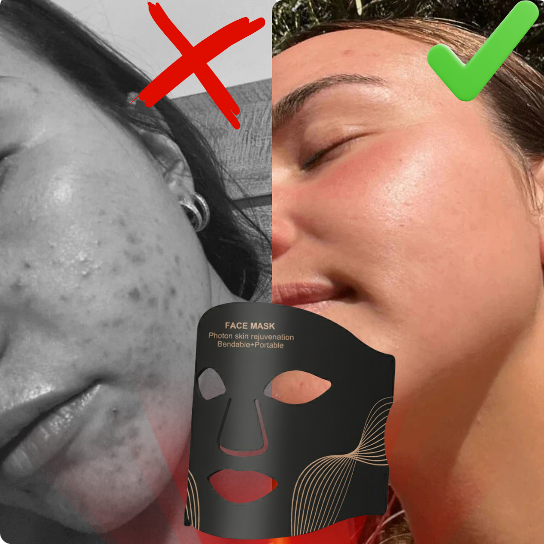 Máscara facial profissional com LED de 7 cores